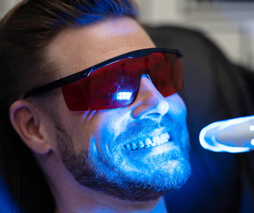 Zahnkosmetik: Strahlend weiße Zähne mit unserer kosmetischen Zahnaufhellung